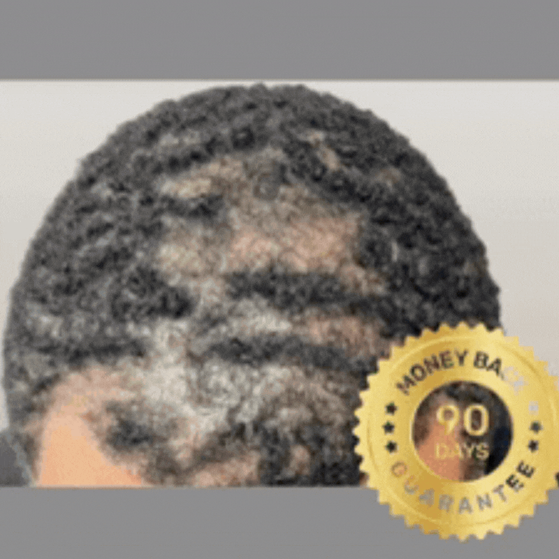 90-day money-back guarantee on hair regrowth results
